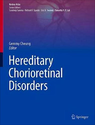 Portada del libro 9789811504136 Hereditary Chorioretinal Disorders (Retina Atlas)