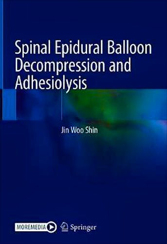 Portada del libro 9789811572647 Spinal Epidural Balloon Decompression and Adhesiolysis