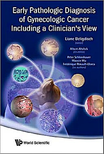 Portada del libro 9789812818959 Early Pathologic Diagnosis of Gynecologic Cancer including a Clinician's View