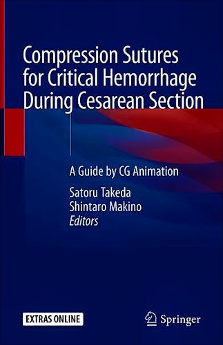 Portada del libro 9789813294592 Compression Sutures for Critical Hemorrhage During Cesarean Section. A Guide by CG Animation