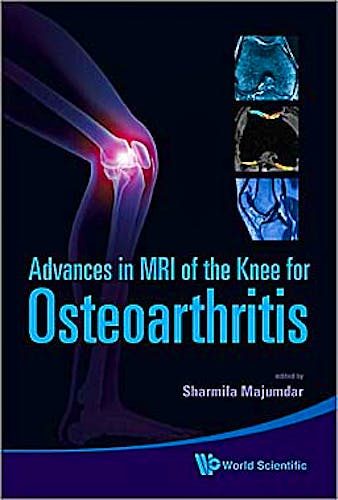 Portada del libro 9789814271707 Advances in Mri of the Knee for Osteoarthritis