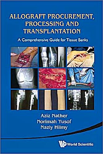 Portada del libro 9789814291187 Allograft Procurement, Processing and Transplantation. a Comprehensive Guide for Tissue Banks