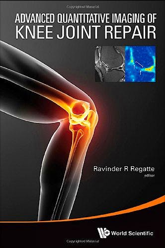 Portada del libro 9789814579322 Advanced Quantitative Imaging of Knee Joint Repair