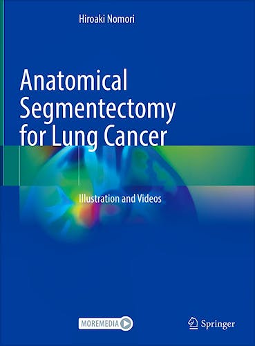 Portada del libro 9789819958566 Anatomical Segmentectomy For Lung Cancer