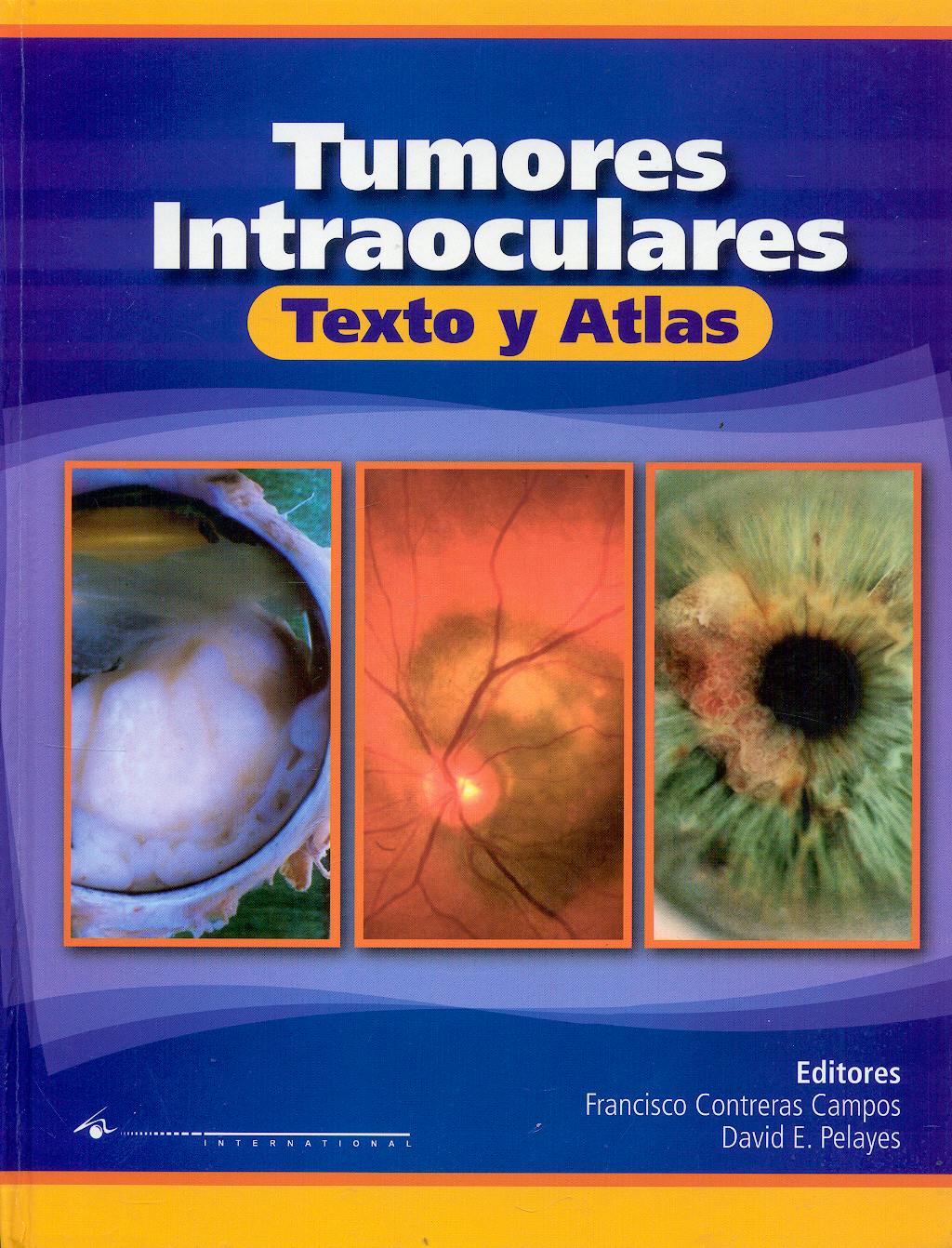 Portada del libro 9789870559337 Tumores Intraoculares. Texto y Atlas