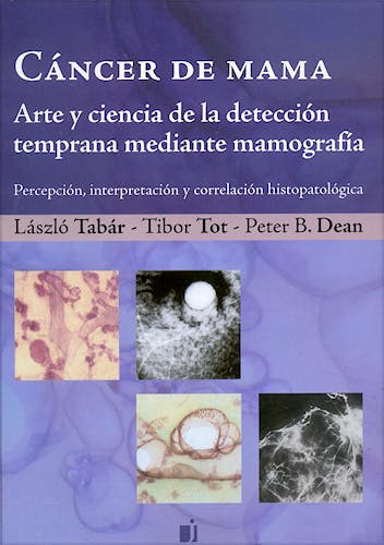 Portada del libro 9789871259052 Cáncer de Mama. Arte y Ciencia de la Detección Temprana Mediante Mamografía. Percepción, Interpretación y Correlación Histopatológica