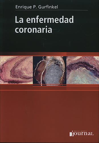 Portada del libro 9789871259175 La Enfermedad Coronaria