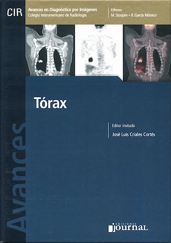Portada del libro 9789871259298 Avances en Diagnóstico por Imágenes 2: Tórax (CIR, Colegio Interamericano de Radiología)