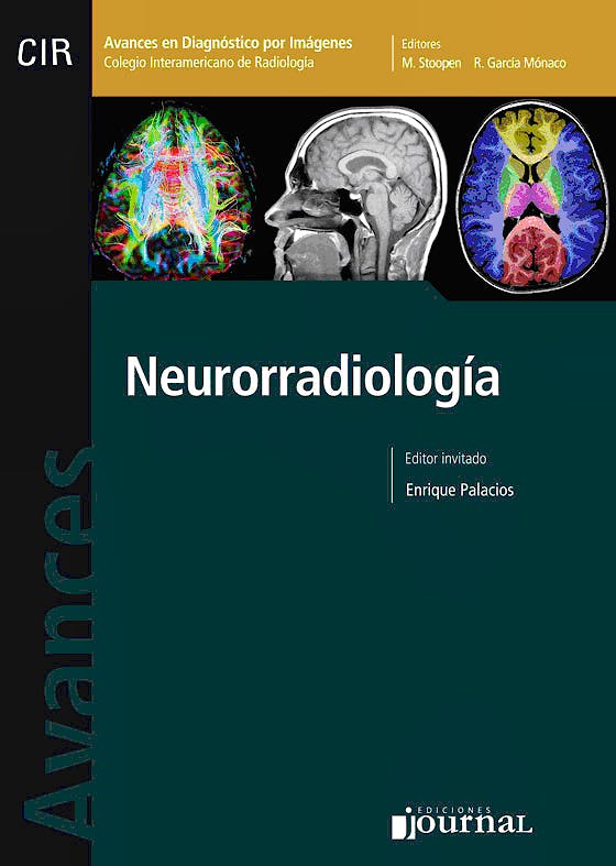 Portada del libro 9789871259359 Avances en Diagnóstico por Imágenes 4: Neurorradiología (CIR, Colegio Interamericano de Radiología)
