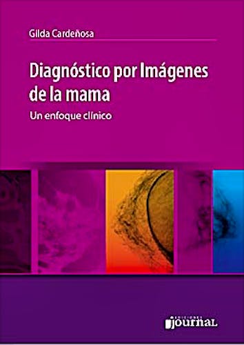Portada del libro 9789871259441 Diagnóstico por Imágenes de la Mama. Un Enfoque Clínico