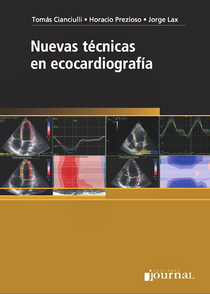 Portada del libro 9789871259656 Nuevas Técnicas en Ecocardiografía