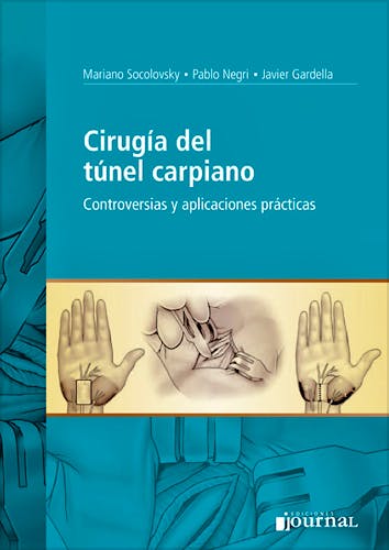 Portada del libro 9789871259724 Cirugía del Túnel Carpiano. Controversias y Aplicaciones Prácticas