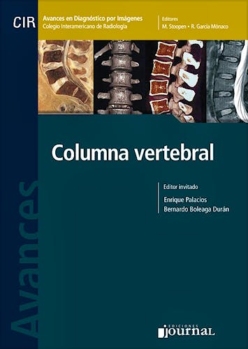 Portada del libro 9789871259762 Avances en Diagnóstico por Imágenes 10: Columna Vertebral (CIR, Colegio Interamericano de Radiología)