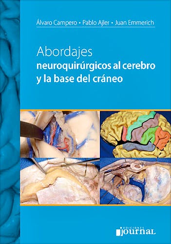Portada del libro 9789871259786 Abordajes Neuroquirúrgicos al Cerebro y la Base del Cráneo