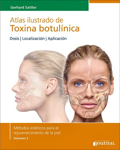 Portada del libro 9789871259861 Atlas Ilustrado de Toxina Botulínica. Dosis, Localización, Aplicación (Métodos Estéticos para el Rejuvenecimiento de la Piel, Vol. 2)