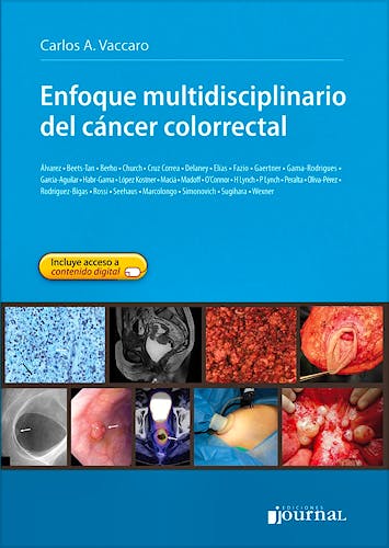 Portada del libro 9789871259922 Enfoque Multidisciplinario del Cáncer Colorrectal