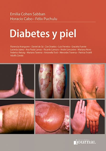 Portada del libro 9789871259953 Diabetes y Piel
