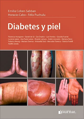 Portada del libro 9789871259953 Diabetes y Piel
