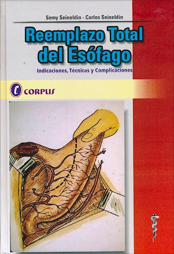 Portada del libro 9789871860029 Reemplazo Total del Esófago. Indicaciones, Técnicas y Complicaciones