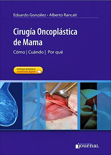 Portada del libro 9789871981014 Cirugía Oncoplástica de Mama. Cómo, Cuándo, Por qué