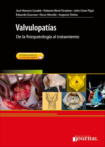 Portada del libro 9789871981243 Valvulopatías. De la Fisiopatología al Tratamiento