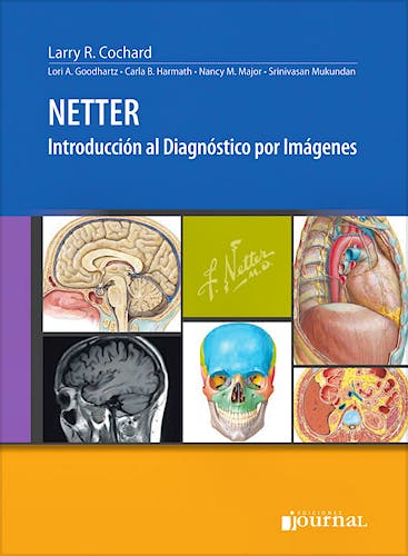 Portada del libro 9789871981311 NETTER Introducción al Diagnóstico por Imágenes