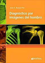 Diagnostico por Imagenes del Hombro