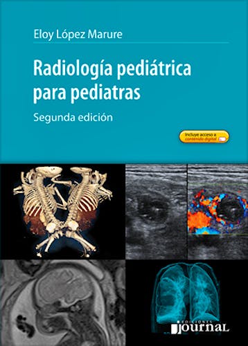 Portada del libro 9789871981793 Radiología Pediátrica para Pediatras