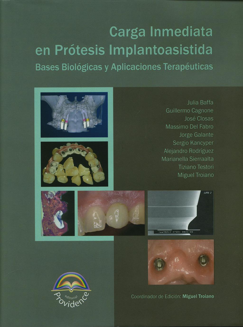 Portada del libro 9789872089030 Carga Inmediata en Protesis Implantoasistida. Bases Biologicas y Aplicaciones Terapeuticas
