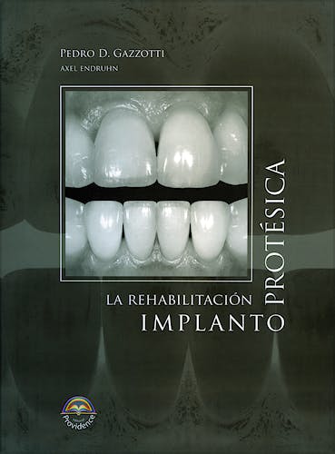 Portada del libro 9789872089047 La Rehabilitación Implantoprotésica