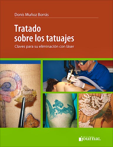 Portada del libro 9789873954184 Tratado sobre los Tatuajes. Claves para su Eliminación con Láser