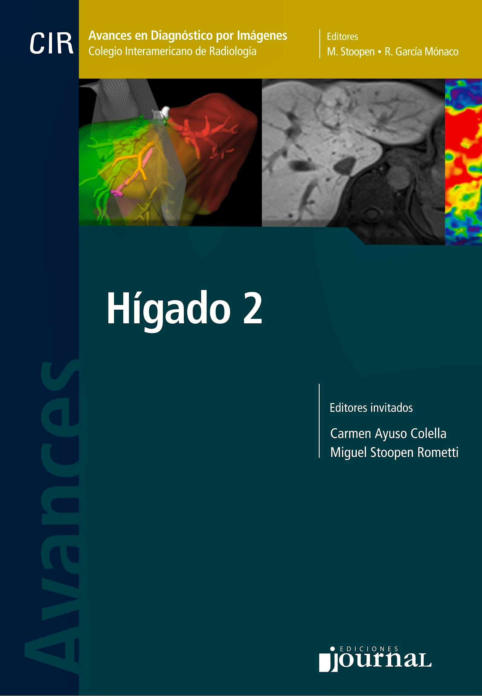 Portada del libro 9789873954344 Avances en Diagnóstico por Imágenes 16: Hígado 2 (CIR, Colegio Interamericano de Radiología)