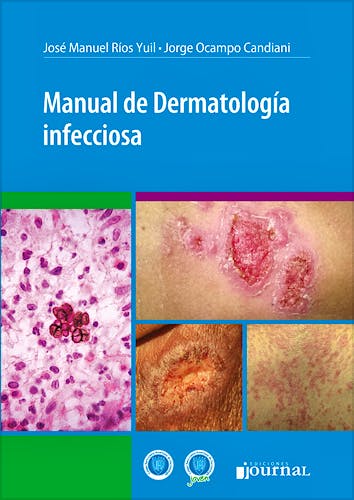 Portada del libro 9789873954405 Manual de Dermatología Infecciosa