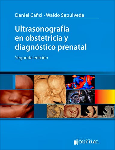 Portada del libro 9789873954511 Ultrasonografía en Obstetricia y Diagnóstico Prenatal