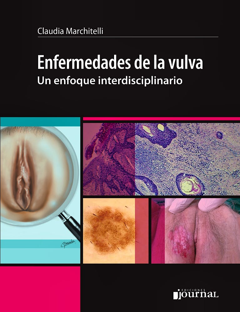 Portada del libro 9789873954559 Enfermedades de la Vulva. Un Enfoque Interdisciplinario