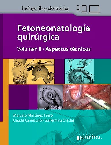 Fetoneonatología Quirúrgica, Vol. 2: Aspectos Técnicos
