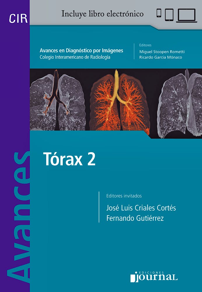 Portada del libro 9789874922038 Avances en Diagnóstico por Imágenes 17: Tórax 2 (CIR, Colegio Interamericano de Radiología)