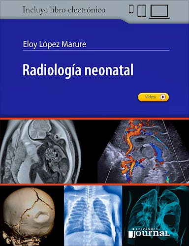 Portada del libro 9789874922106 Radiología Neonatal