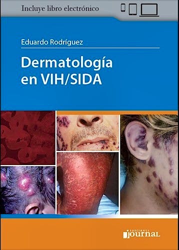 Portada del libro 9789874922380 Dermatología en VIH/SIDA