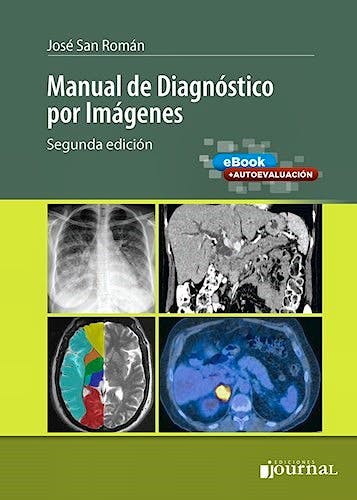 Portada del libro 9789874922625 Manual de Diagnóstico por Imágenes (Incluye Autoevaluación)