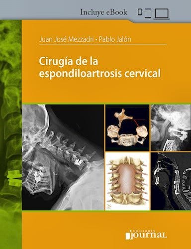 Portada del libro 9789874922694 Cirugía de la Espondiloartrosis Cervical