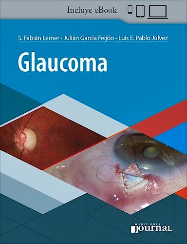 Portada del libro 9789874922724 Glaucoma