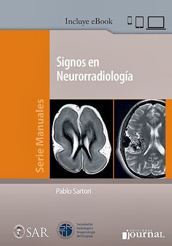 Portada del libro 9789874922809 Signos en Neurorradiología