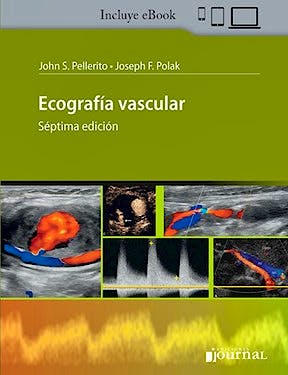 Ecografía Vascular