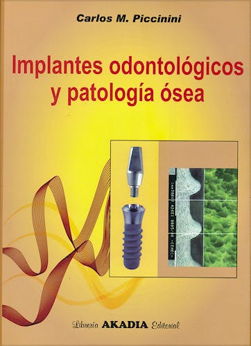 Portada del libro 9789875701939 Implantes Odontologicos y Patologia Osea