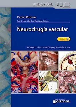 Neurocirugía Vascular