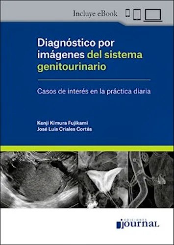 Portada del libro 9789878452159 Diagnóstico por Imágenes del Sistema Genitourinario. Casos de Interés en la Práctica Diaria