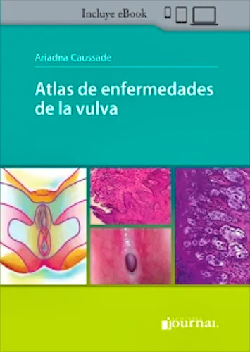 Portada del libro 9789878452210 Atlas de Enfermedades de la Vulva