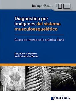 Diagnóstico por Imágenes del Sistema Musculoesquelético. Casos de Interés en la Práctica Diaria