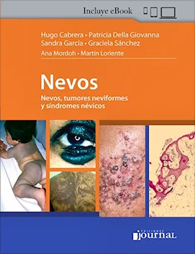 Portada del libro 9789878452418 Nevos. Nevos, Tumores Neviformes y Síndromes Névicos